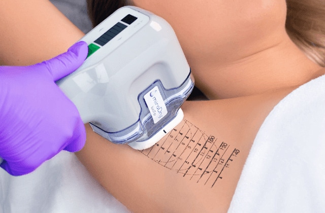 医師が必ず照射を行う